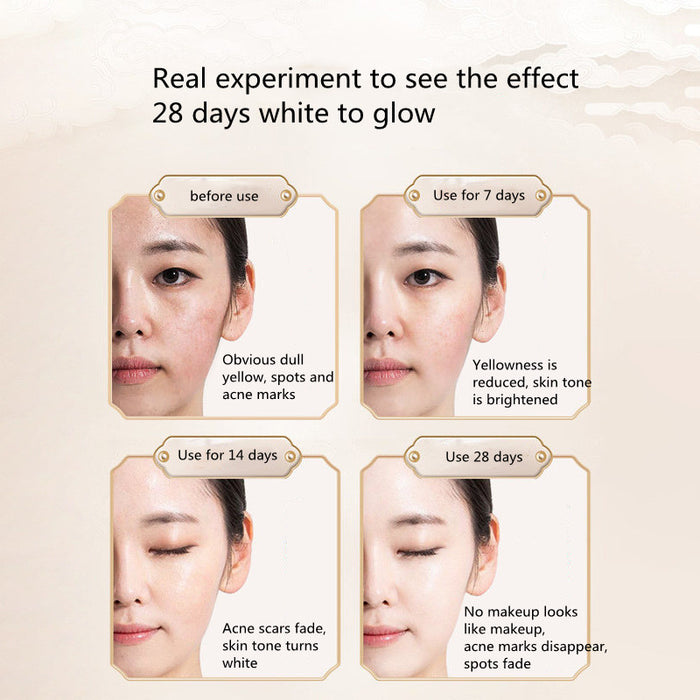 Moisturizing Moisturizing Diluted Spots Refined Pores Hydroquinone Serum